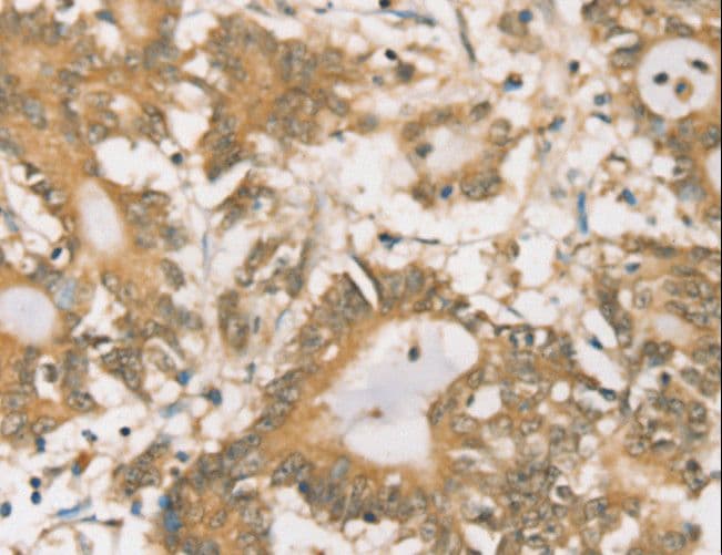 Polyclonal Rabbit anti-Human SIGLEC15 Antibody (IHC)