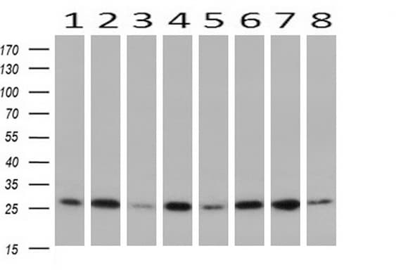 IHC-plus™ Monoclonal Mouse anti-Human GBAS Antibody (clone 1B8, IHC, IF, WB)