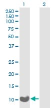 XTP4 / C17orf37 Antibody (clone 3B5)