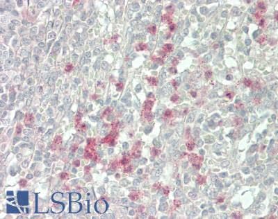 IHC-plus™ PIK3CG / PI3K Gamma Antibody (Internal)