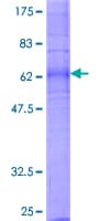Human LPAR1 / LPA1 / EDG2 Protein (Recombinant GST)
