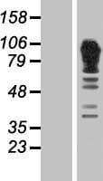 ADD1 / Adducin Alpha Protein (Over-Expression Lysate Myc-DDK (Flag))