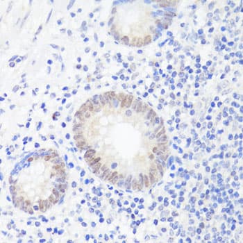 Polyclonal Rabbit anti-Human ESRRA / ERR Alpha Antibody (IHC, WB)