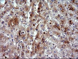 Monoclonal Mouse anti-Human PLA2G16 / HRASLS3 Antibody (clone OTI1A5, IHC, IF, WB)