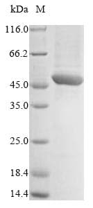 Plasmodium falciparum VAR2CSA DBL5 Protein (Recombinant 10His, N-terminus + Myc, C-terminus)