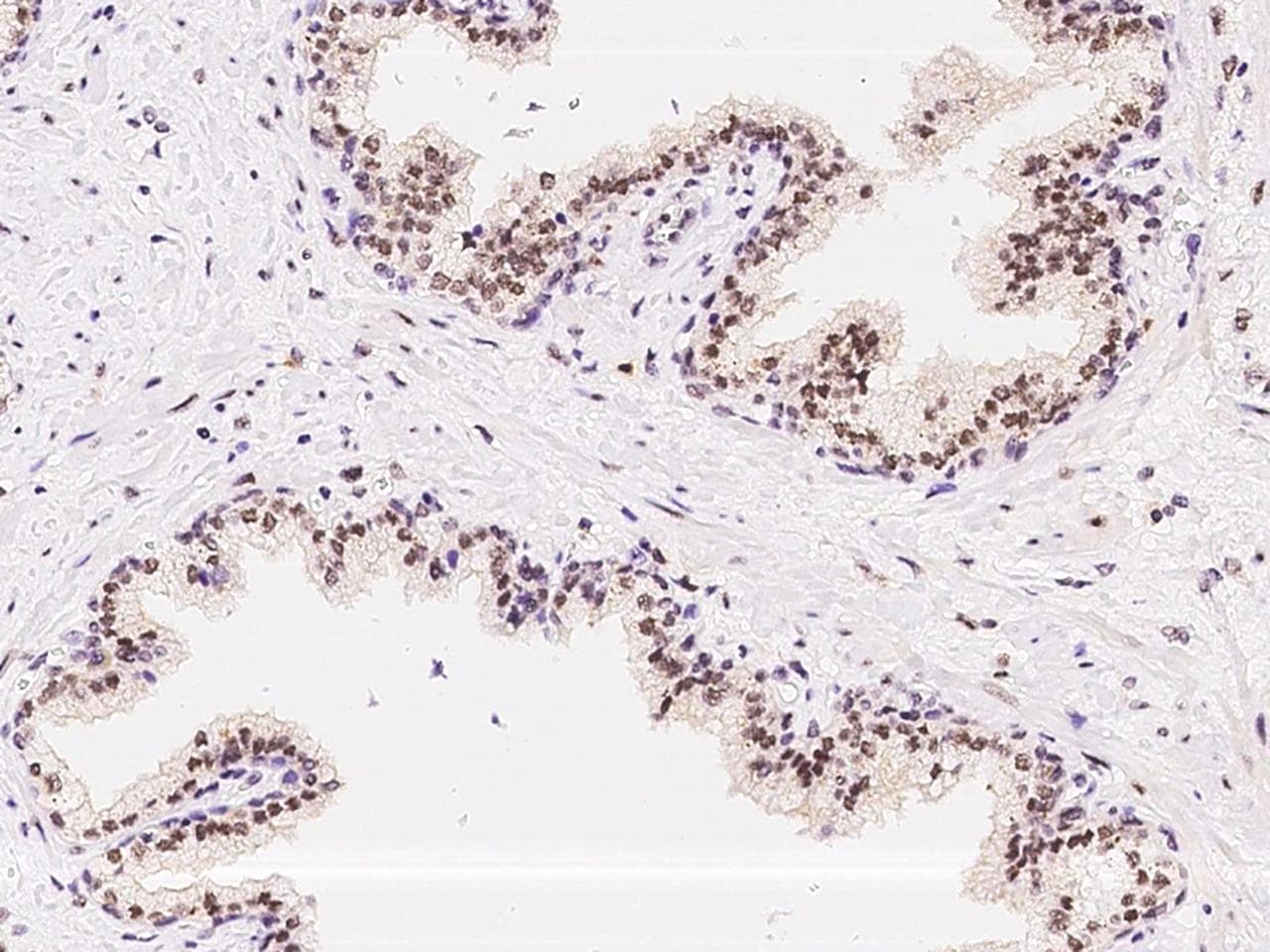 ATR Antibody
