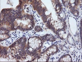 PIK3R5 Antibody (clone OTI2A6)