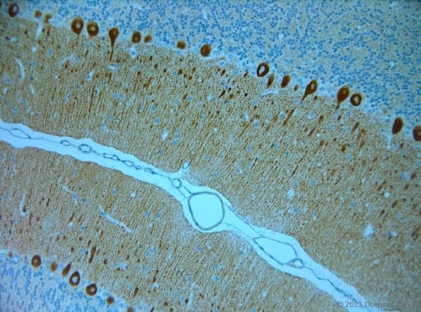 Polyclonal Rabbit anti-Human ITPR1 / IP3 Receptor Type 1 Antibody (aa700-750, IHC)