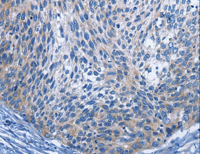 IL2RB / CD122 Antibody
