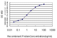 IHC-plus™ Monoclonal Mouse anti-Human YAP / YAP1 Antibody (clone 2F12, IHC, IF, WB)