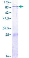 Human ARSK / Arylsulfatase K Protein (Recombinant GST)