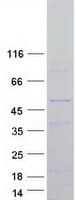 Human NOXO1 Protein (Recombinant Myc-DDK (Flag))