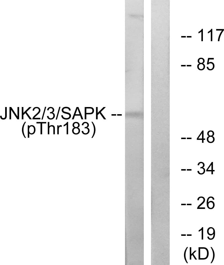 JNK1+2+3 Antibody (phospho-Thr183)