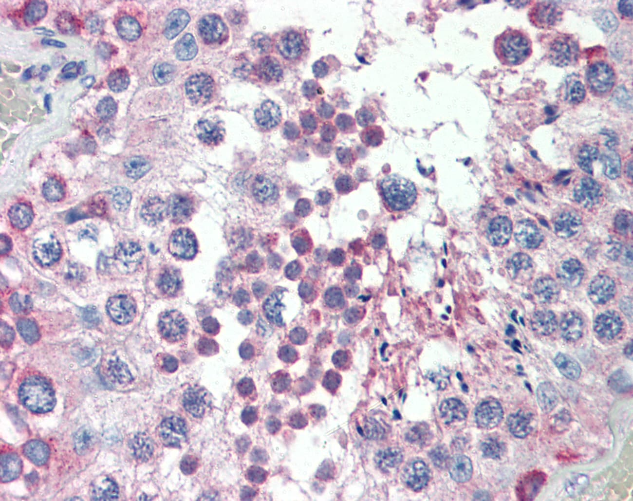MED4 Antibody (aa146-195)