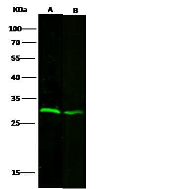 VAPB Antibody (Preservative Free)
