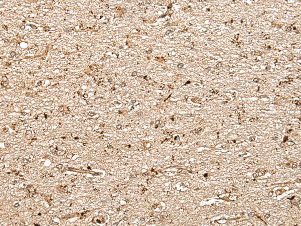 Polyclonal Rabbit anti-Human MCPH1 Antibody (IHC)