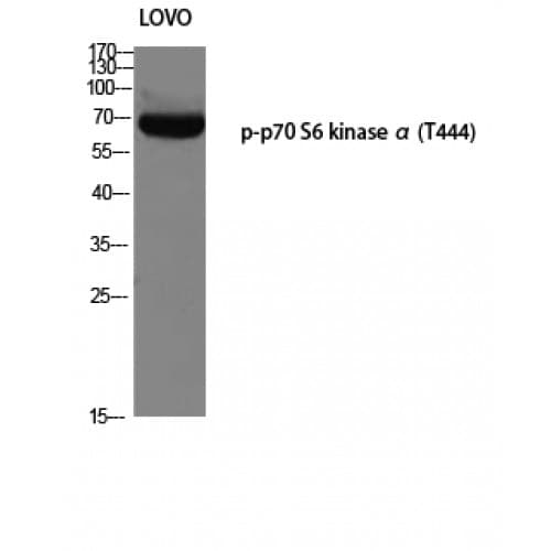RPS6KB1 / P70S6K / S6K Antibody (380-460 aa)