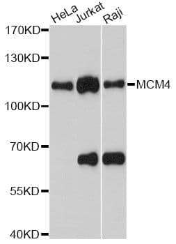 MCM4 Antibody