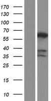 PPP3CB Protein (Over-Expression Lysate Myc-DDK (Flag))
