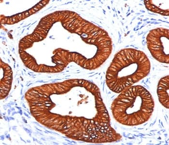 Cytokeratin 1+8 Antibody (clone DC10)