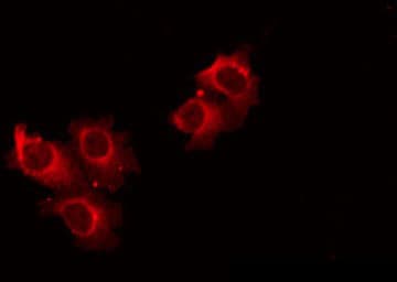 Polyclonal Rabbit anti-Human ACOT4 Antibody (IF, WB)