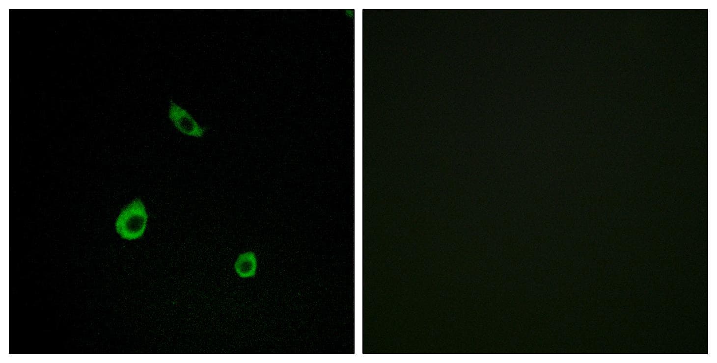 MAPK15 / ERK7 Antibody