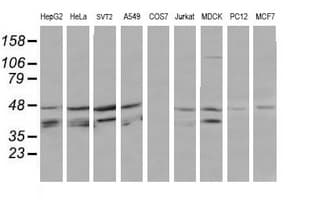 MAP2K3 / MEK3 / MKK3 Antibody (clone OTI4G4)
