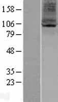 HARV1 / ARV1 Protein (Over-Expression Lysate Myc-DDK (Flag))