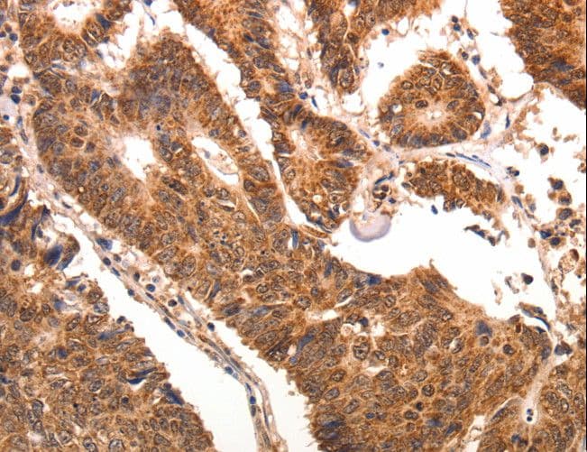 IHC-plus™ CCL17 / TARC Antibody