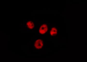 UBR5 Antibody