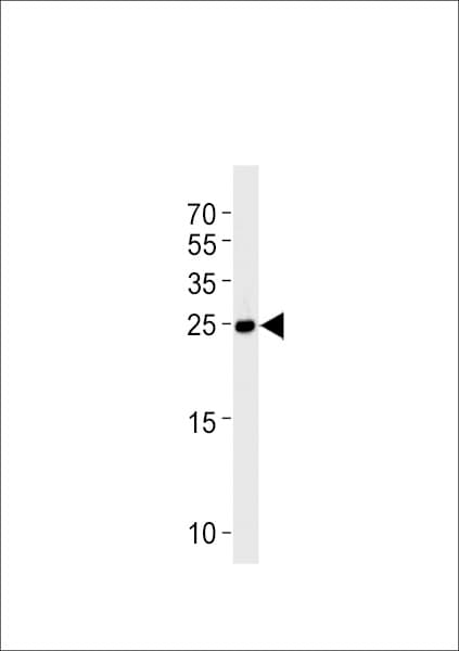 dusp22a Antibody (aa172-195)