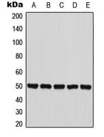 PANK2 Antibody (Internal)
