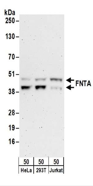 IHC-plus™ PTAR2 / FNTA Antibody (aa329-379)