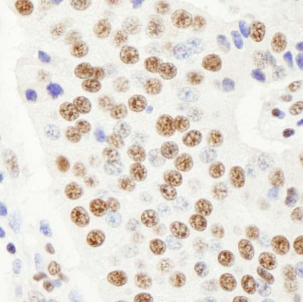 HFip1 / FIP1L1 Antibody (aa544-594)