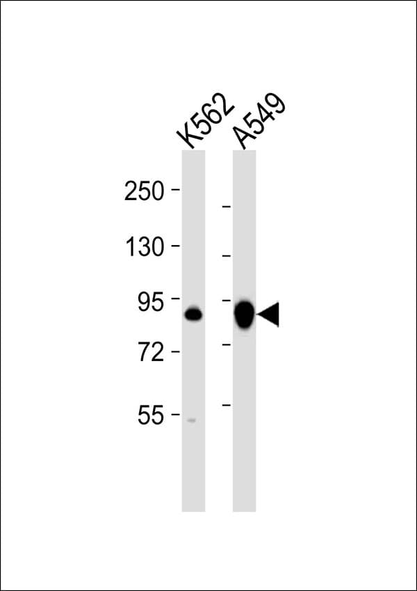 TGM2 / Transglutaminase 2 Antibody