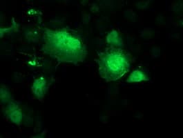 SMS / Spermine Synthase Antibody (clone OTI 1A7)