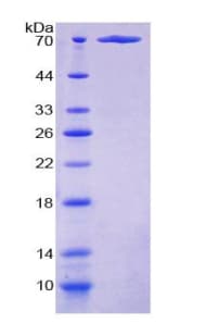 Human KIAA1524 / p90 Autoantigen Protein (Recombinant His-GST)