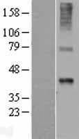 WNT7B Protein (Over-Expression Lysate Myc-DDK (Flag))