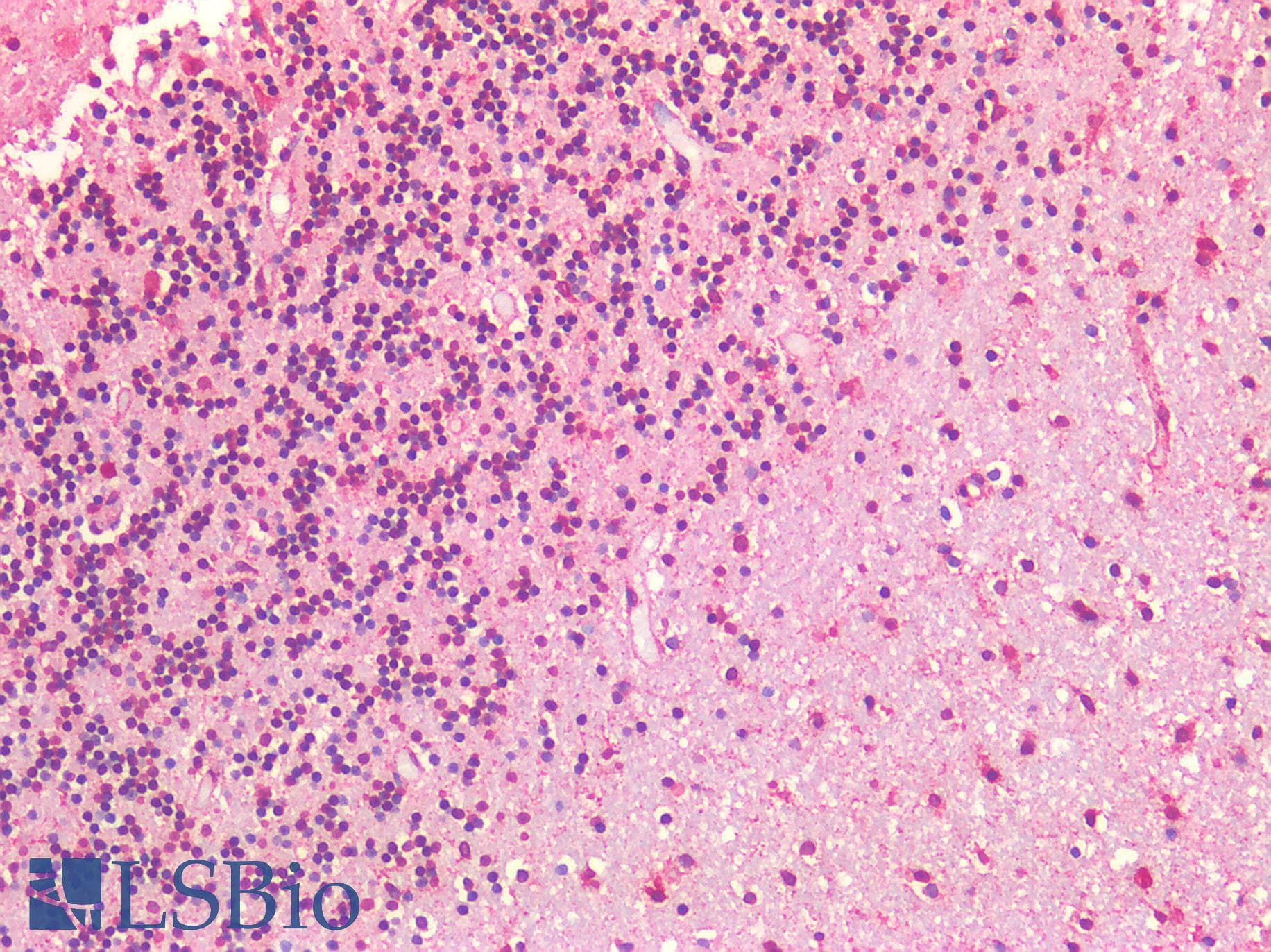 IHC-plus™ Polyclonal Rabbit anti-Human IGF1R / IGF1 Receptor Antibody (IHC)