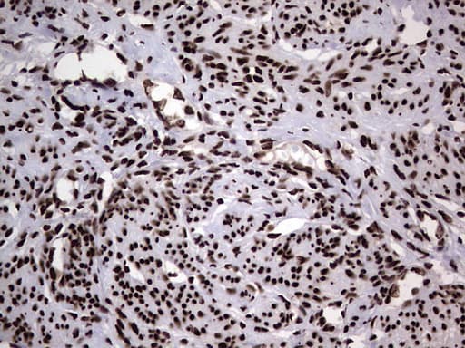 HNRNPL / hnRNP L Antibody (aa270-502, clone OTI2E4)