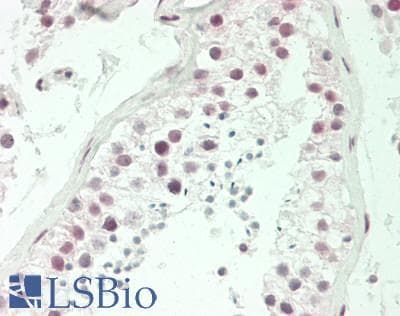 IHC-plus™ Polyclonal Rabbit anti-Human SRSF10 / FUSIP1 Antibody (aa133-183, IHC, WB)