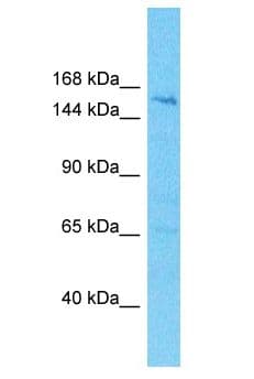 Polyclonal Rabbit anti-Human HISPPD2A / VIP1 Antibody (aa1133-1181, WB)