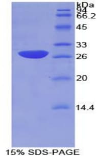 Mouse NFKBIB / IKB Beta / IKBB Protein (Recombinant His-T7)