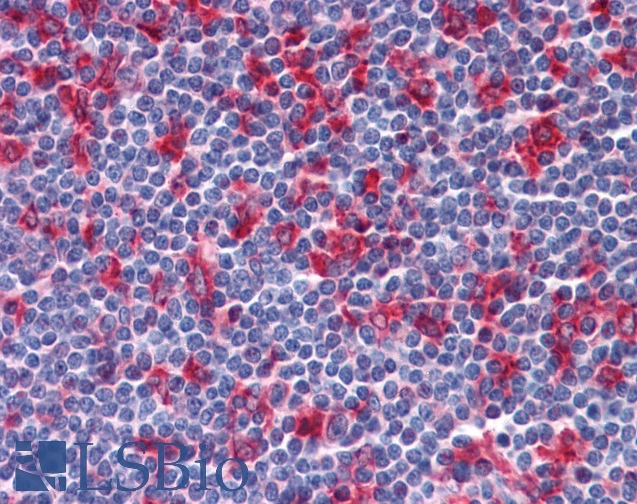 IHC-plus™ VCAM1 / CD106 Antibody (clone 6G9)