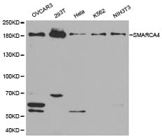 Polyclonal Rabbit anti-Human SMARCA4 / BRG1 Antibody (IHC, WB)