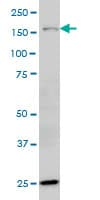 IHC-plus™ HYOU1 / ORP150 Antibody (clone 6F7)