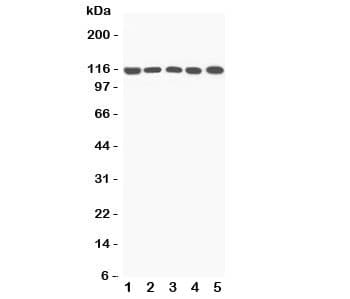 Polyclonal Rabbit anti-Rat Complement C5a Antibody (aa1-18, IHC, WB)