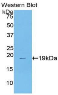 CSF3 / G-CSF Antibody (aa47-205)