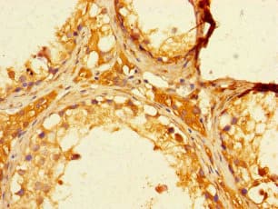 FBXO15 / FBX15 Antibody