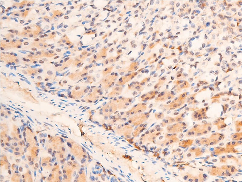 Polyclonal Rabbit anti-Human CHEK1 / CHK1 Antibody (phospho-Ser280, IHC, IF, WB)